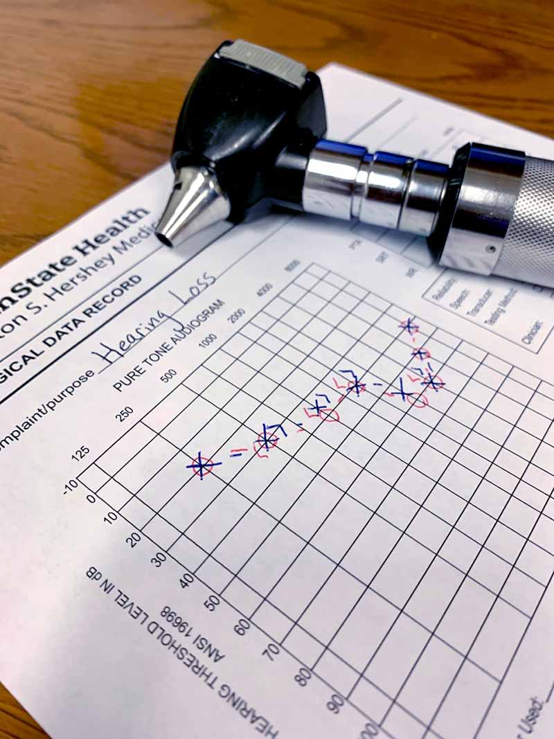 一个耳镜放在一个用来记录听力测试结果的表格上。