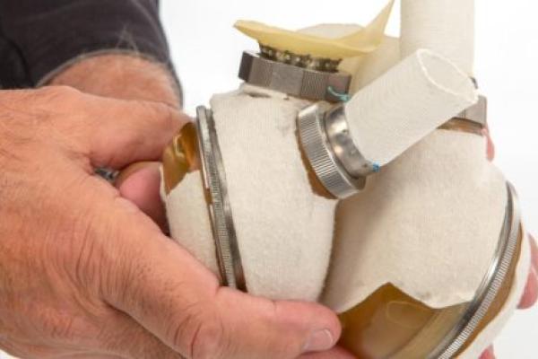 Hands hold an artificial heart device.